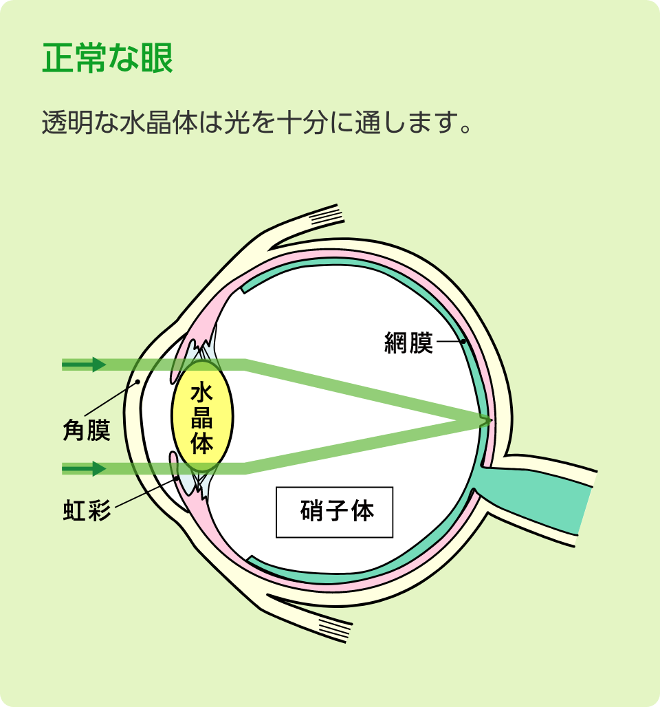 正常な目